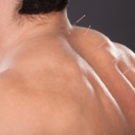 North Calgary Acupuncture