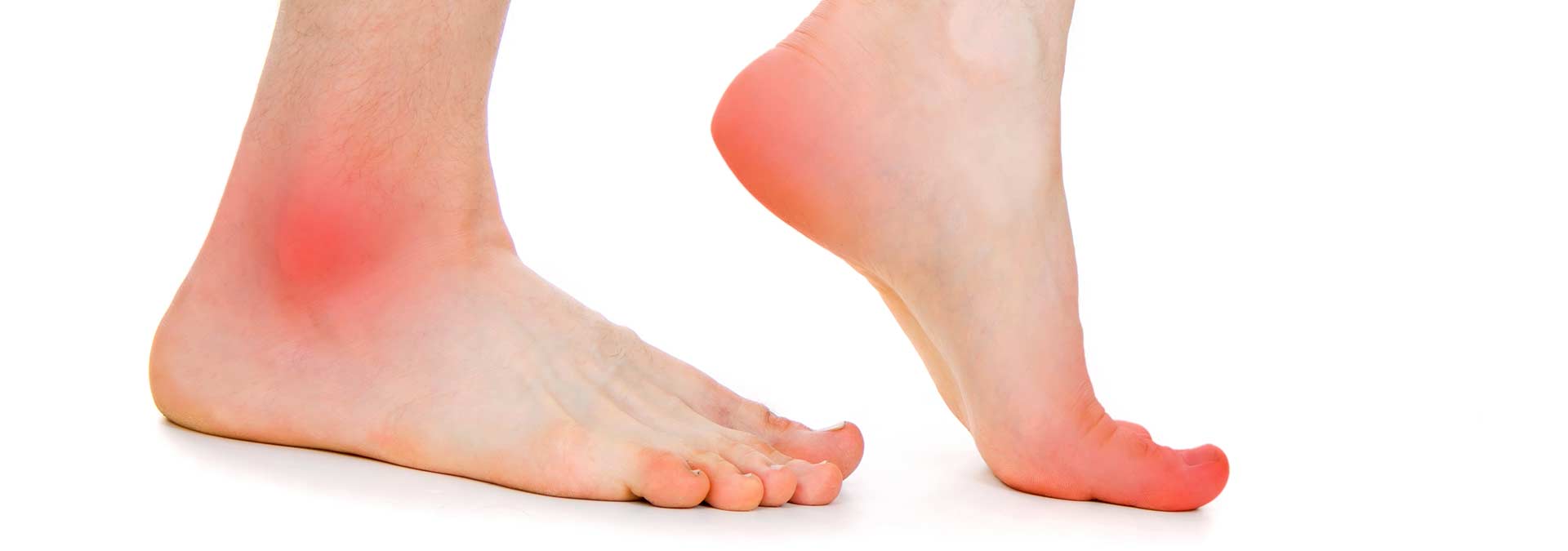 Custom Foot Orthotics | Northern Hills Chiropractic | North Calgary AB