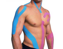 North Calgary Kinesio Taping | Northern Hills Chiropractor | North Calgary Chiropractor